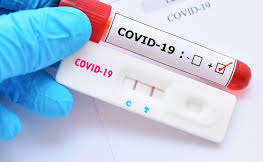 Convênio facilita testes para coronavírus